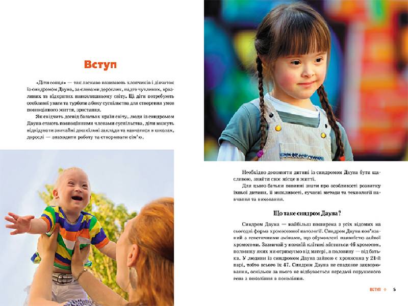 Поради батькам і педагогам. Сонячні діти. Діти із синдромом Дауна - Зображення 2