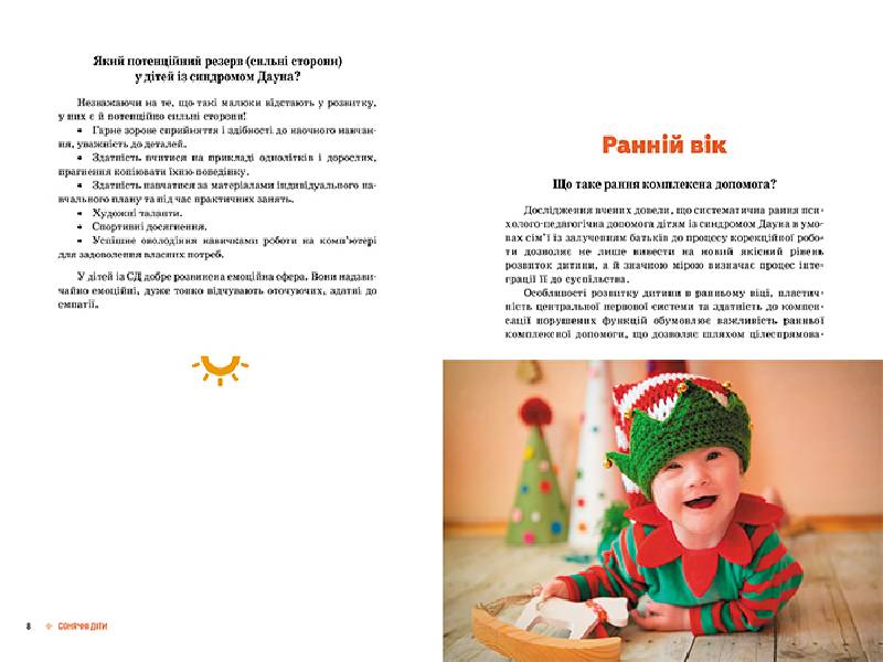 Поради батькам і педагогам. Сонячні діти. Діти із синдромом Дауна - Зображення 4